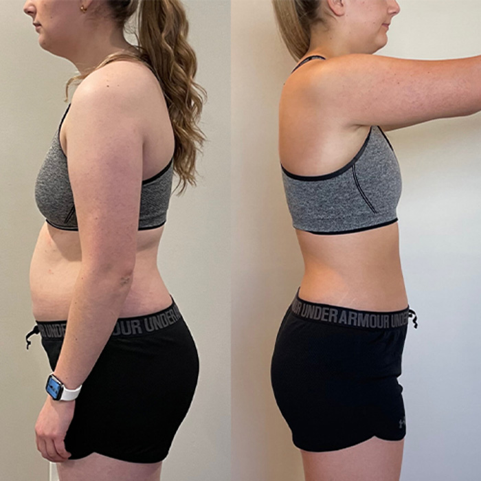 Transformation 2